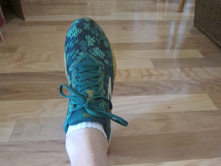 Joseph P. Fisher's pre-surgery foot in his lucky green and gold shoe